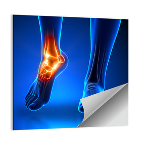 Ankle Pain Wall Art