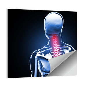 Painful Spine Vertebrae Pain Anatomy Wall Art