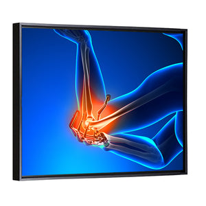 Elbow Pain Wall Art