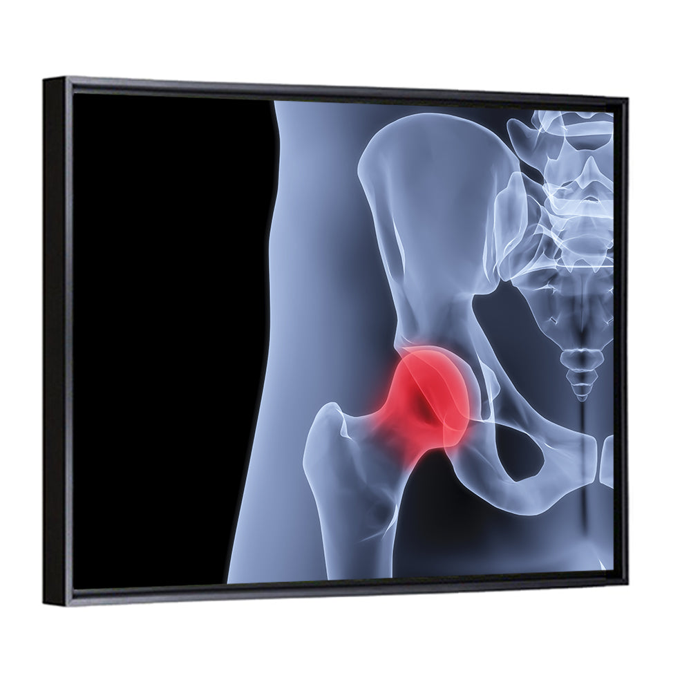 Lateral Hip Joint X-ray Wall Art