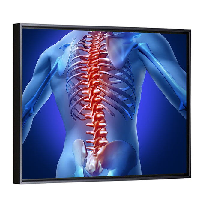 Spine Pain Anatomy Illustration Wall Art as a framed canvas
