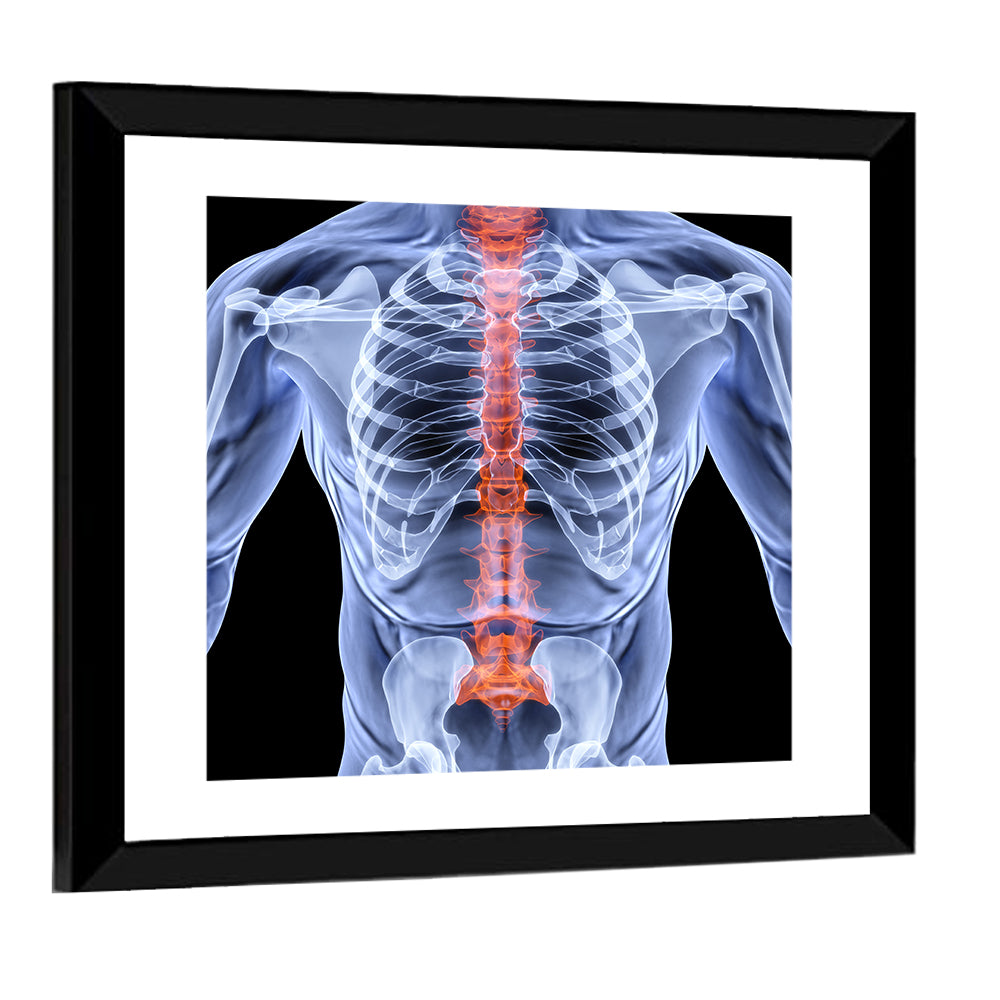 Men Backbone X-Ray Wall Art