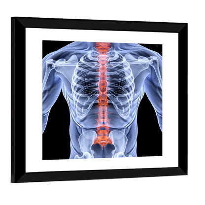 Men Backbone X-Ray Wall Art