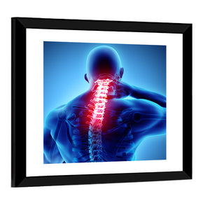 Neck & Spine Painful X-Ray Wall Art