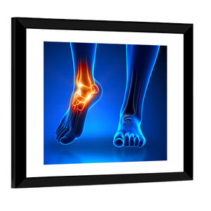 Ankle Pain Anatomy Wall Art