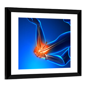 Elbow Pain Wall Art