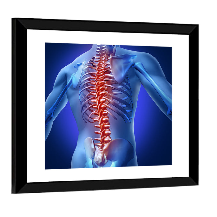 Spine Pain Anatomy Illustration Wall Art as a framed print