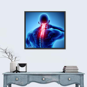 Neck & Spine Painful X-Ray Wall Art