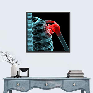 Painful Shoulder X Ray Wall Art