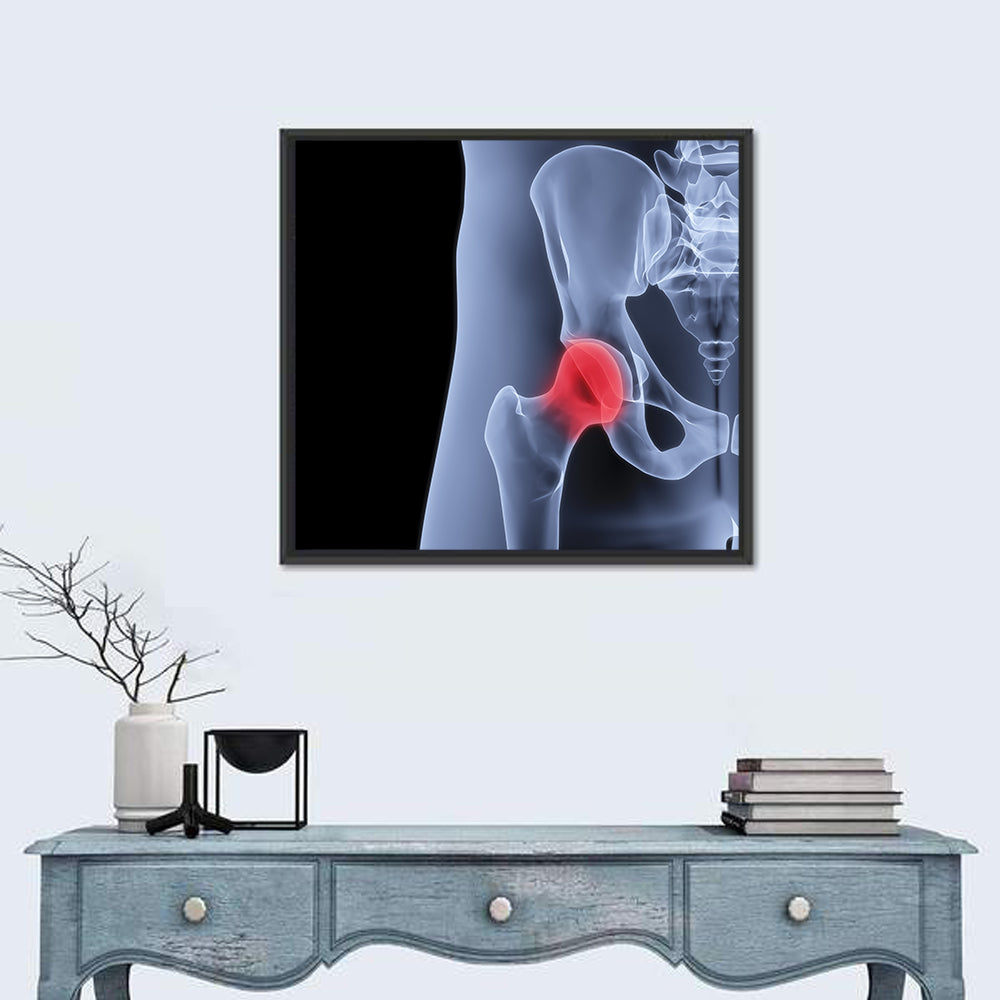 Lateral Hip Joint X-ray Wall Art