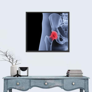 Male Pelvis Under The X-Rays Wall Art