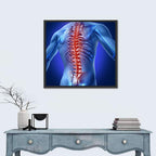 Spine Pain Anatomy Illustration Wall Art