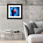 Shoulder Pain X-ray Wall Art