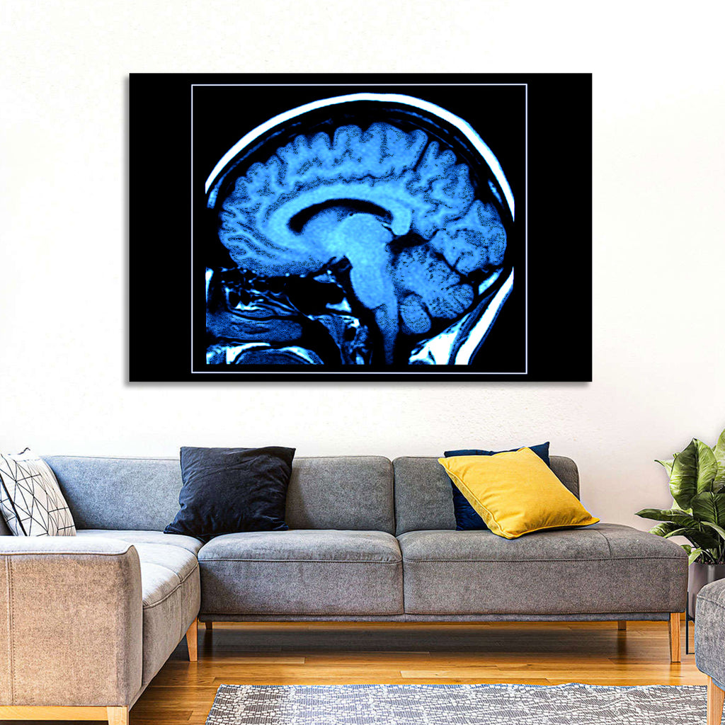 Sagittal Brain Mri Scan in Blue Wall Art