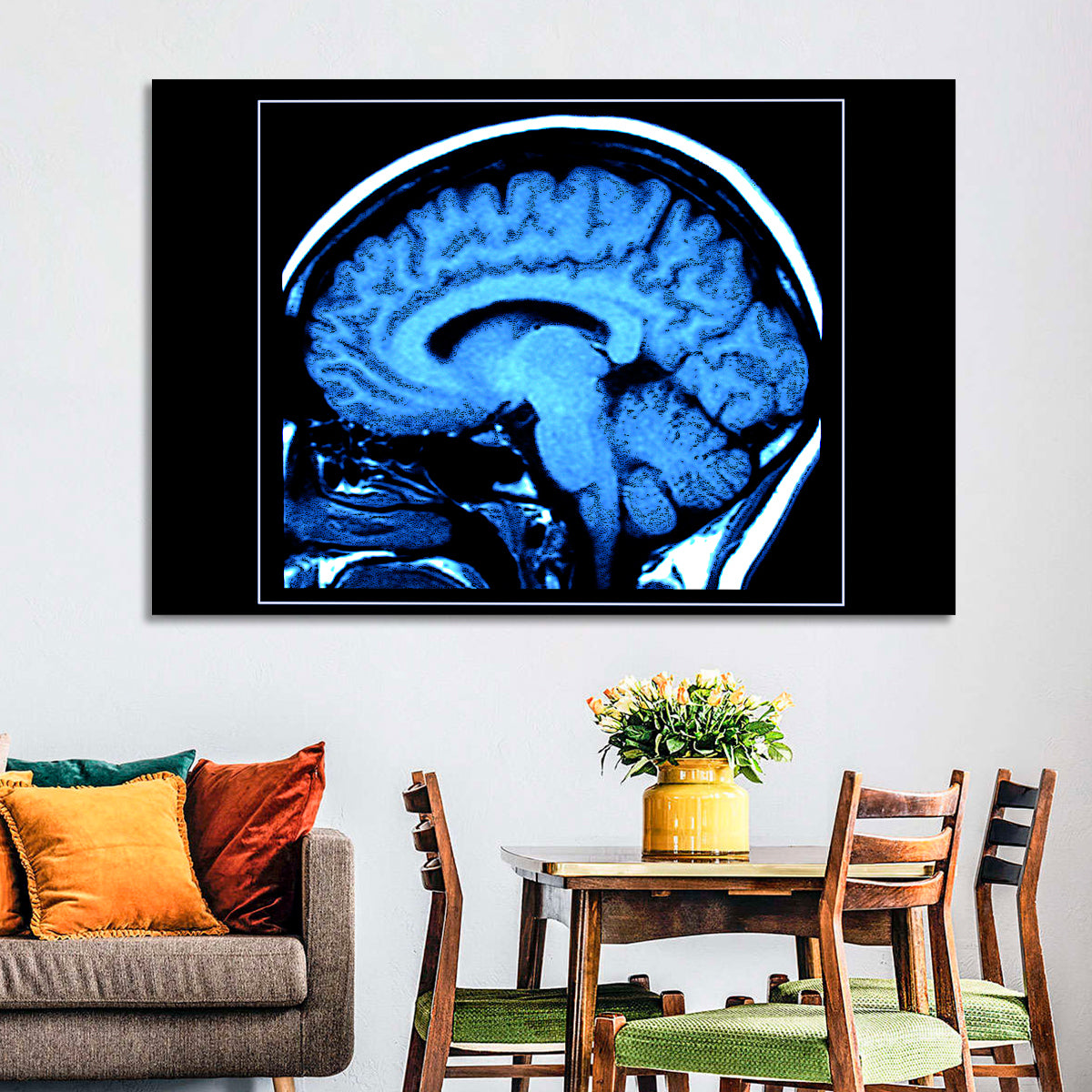 Sagittal Brain Mri Scan in Blue Wall Art in a room, landscape