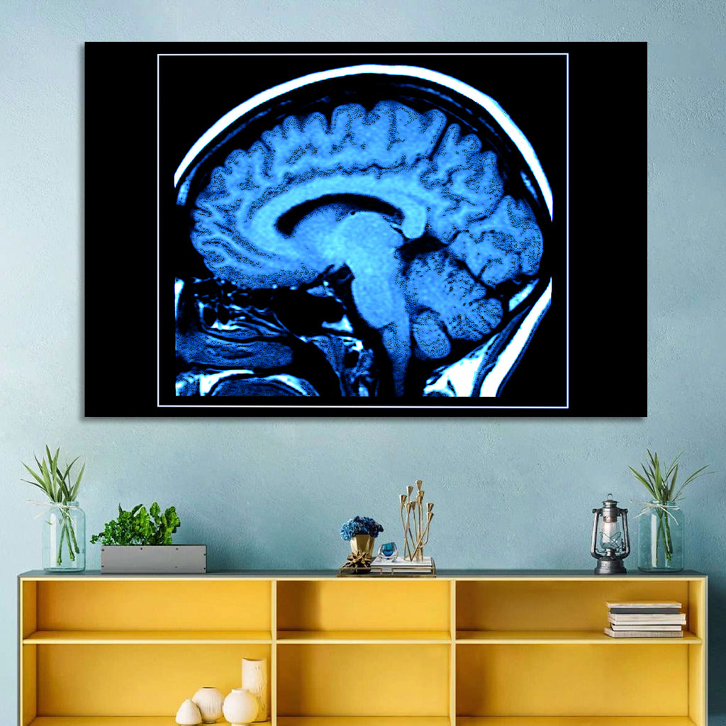 Sagittal Brain Mri Scan in Blue Wall Art