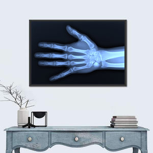 Hand X-Ray Wall Art