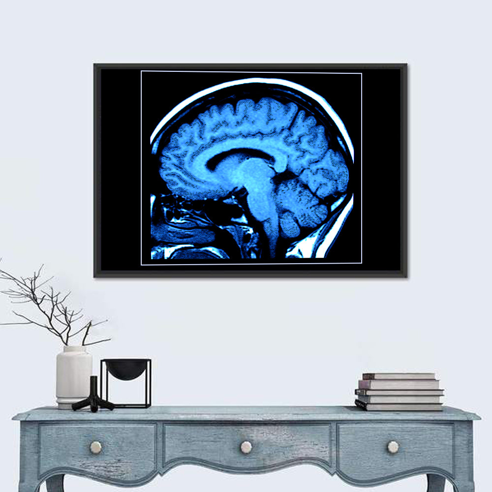 Human Brain MRI Wall Art