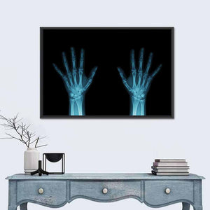 Hands X-Ray Wall Art