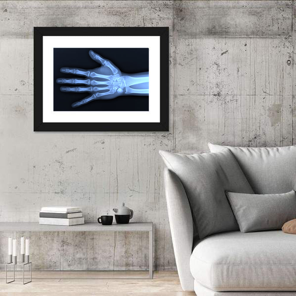 Hand X-Ray Wall Art
