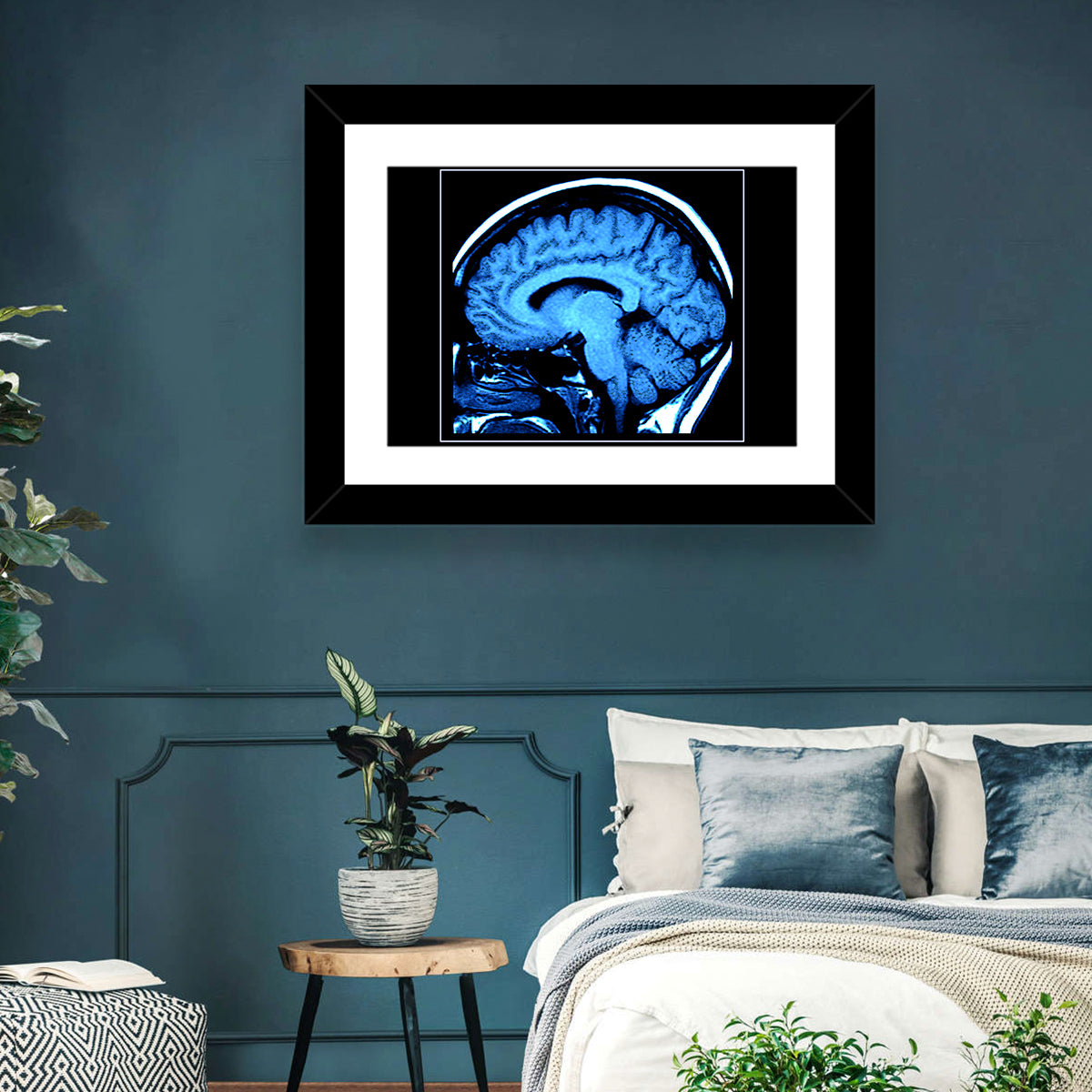 Sagittal Brain Mri Scan in Blue Wall Art in a room, landscape