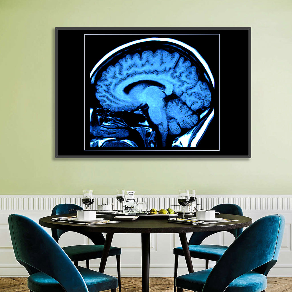 Sagittal Brain Mri Scan in Blue Wall Art