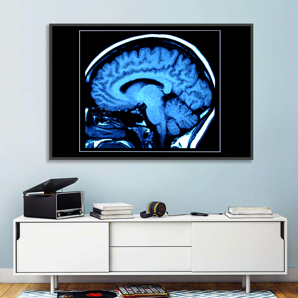 Sagittal Brain Mri Scan in Blue Wall Art
