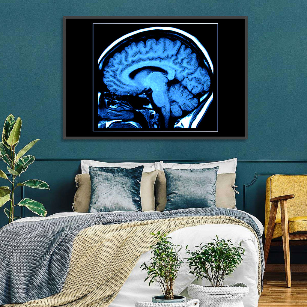 Sagittal Brain Mri Scan in Blue Wall Art