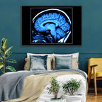 Sagittal Brain Mri Scan in Blue Wall Art