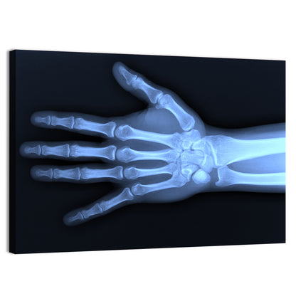 Hand X-Ray Wall Art