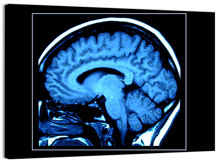 Sagittal Brain Mri Scan in Blue Wall Art as a canvas print