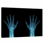 Blue X-ray Hands Wall Art