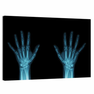 Hands X-Ray Wall Art