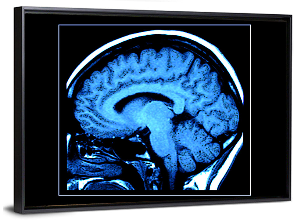 Sagittal Brain Mri Scan in Blue Wall Art