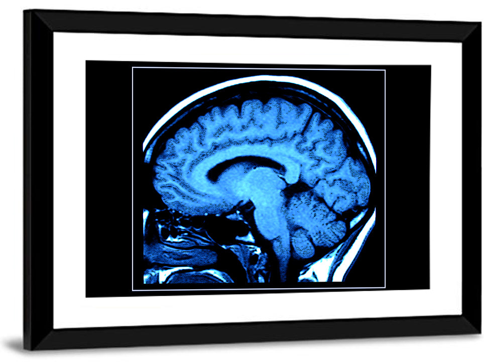 Sagittal Brain Mri Scan in Blue Wall Art