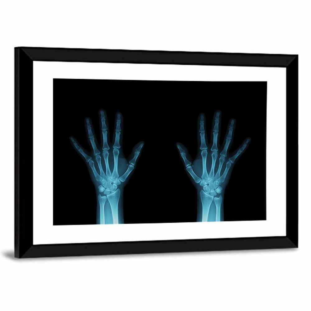 Hands X-Ray Wall Art