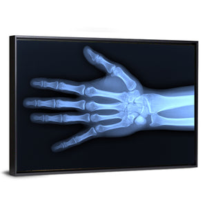 Hand X-Ray Wall Art