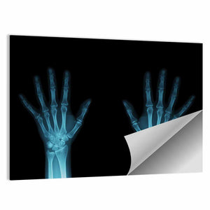 Hands X-Ray Wall Art