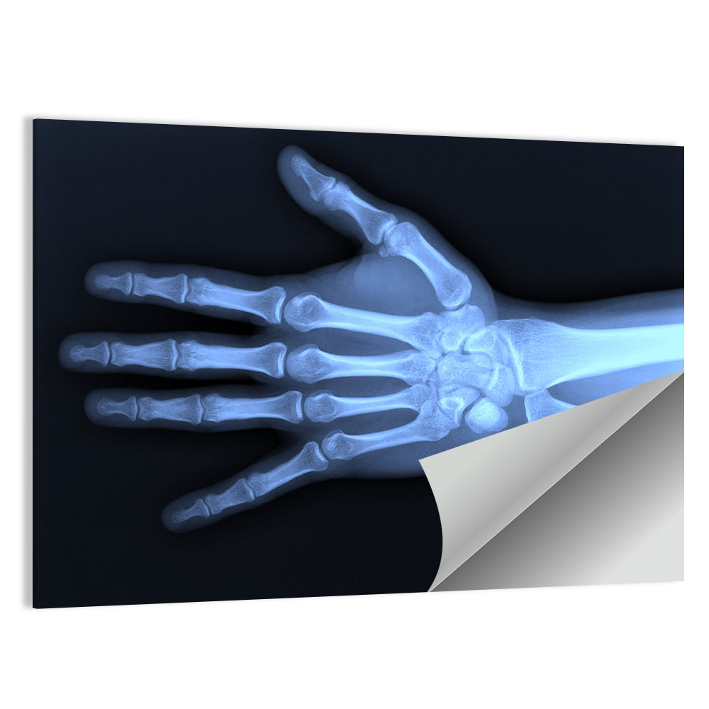 Hand X-Ray Wall Art