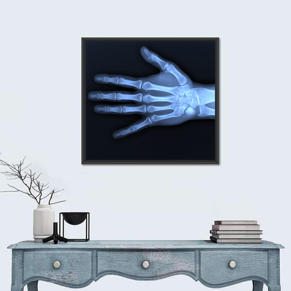 Hand X-Ray Wall Art