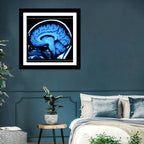Sagittal Brain Mri Scan in Blue Wall Art