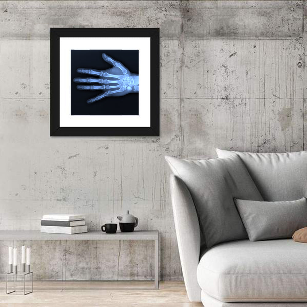 Hand X-Ray Wall Art