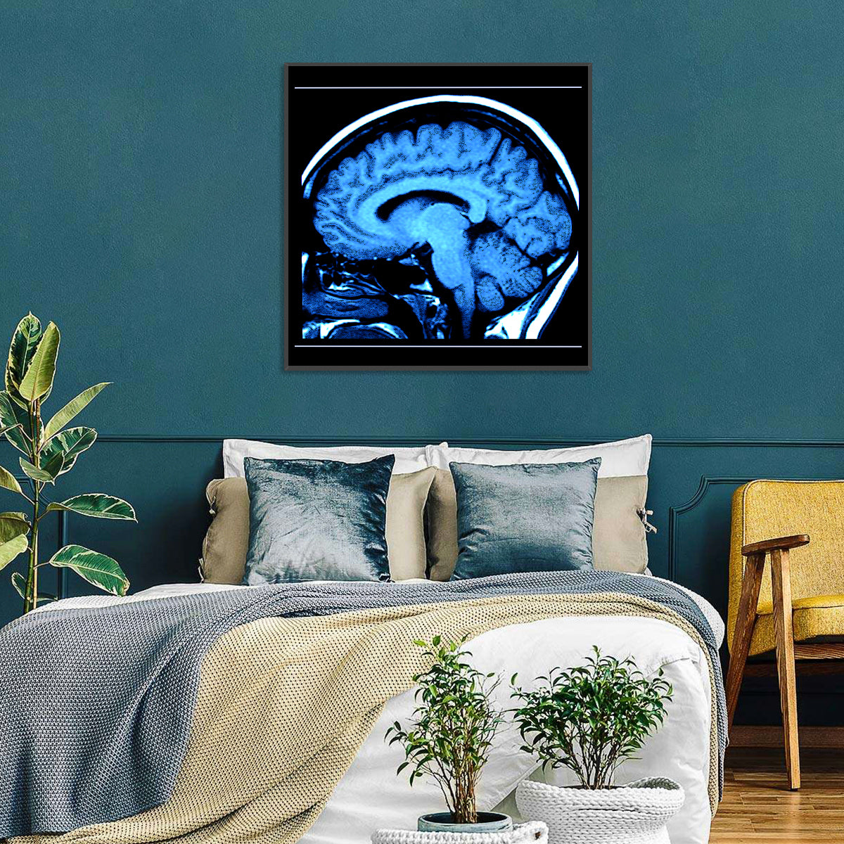 Sagittal Brain Mri Scan in Blue Wall Art