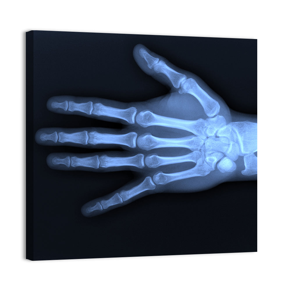 Hand X-Ray Wall Art
