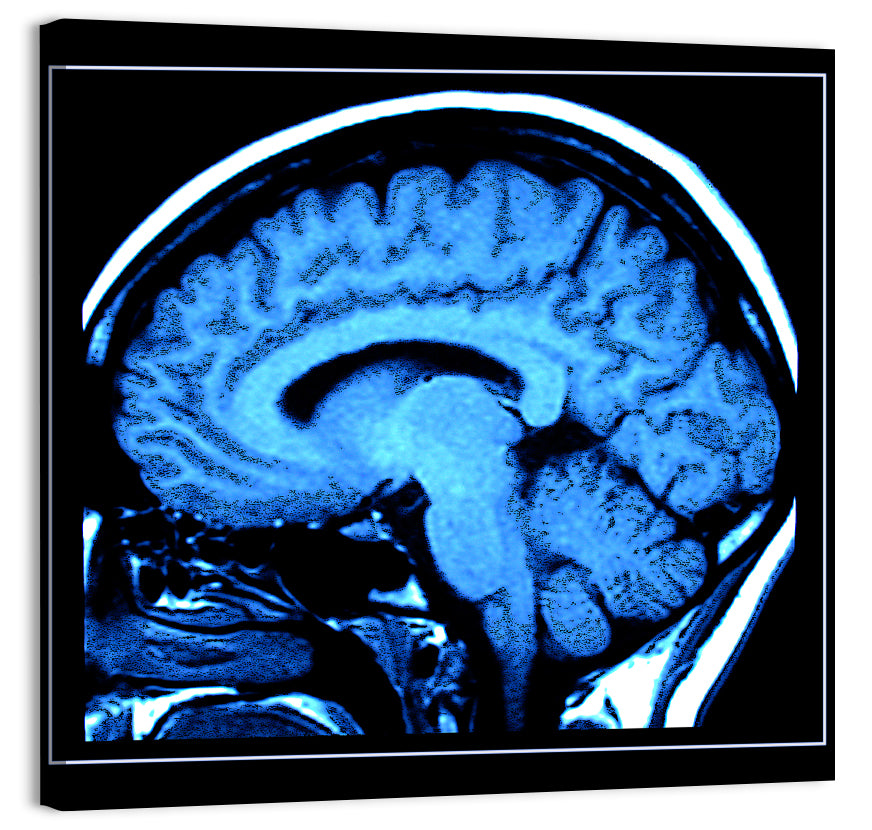 Sagittal Brain Mri Scan in Blue Wall Art