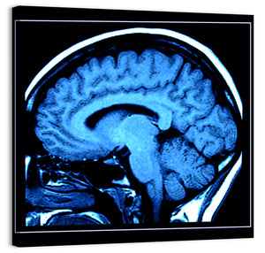 Human Brain MRI Wall Art