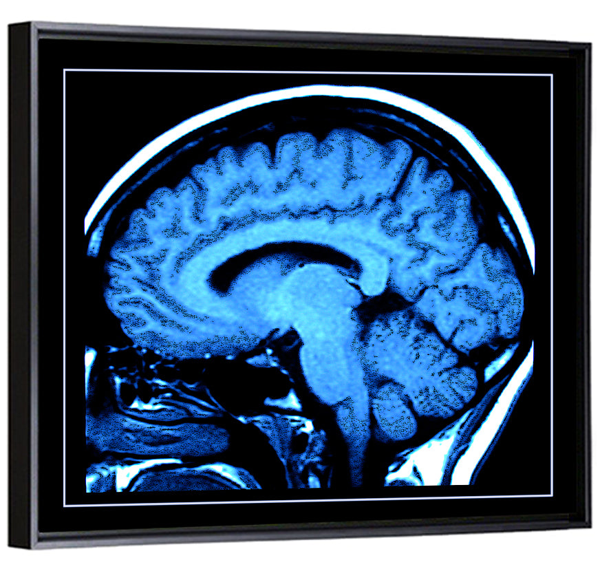 Sagittal Brain Mri Scan in Blue Wall Art