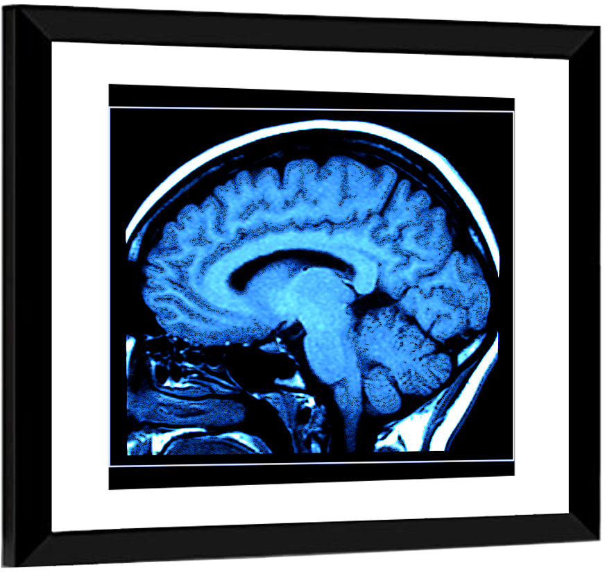 Human Brain MRI Wall Art