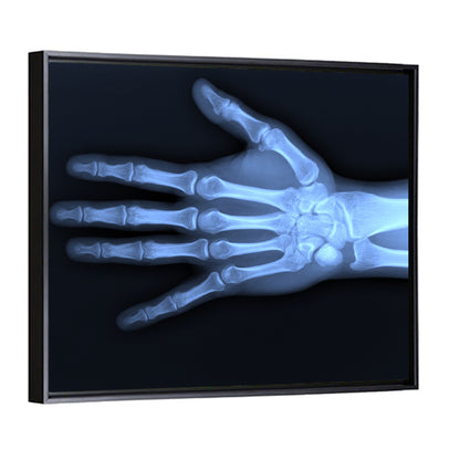 Hand X-Ray Wall Art