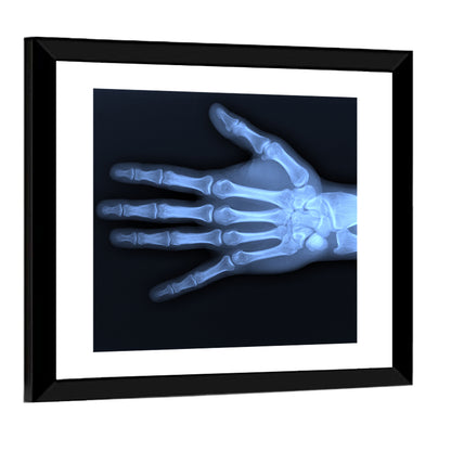 Hand X-Ray Wall Art